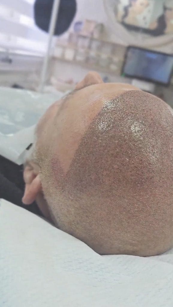 איפור קבוע זקיקי שיער